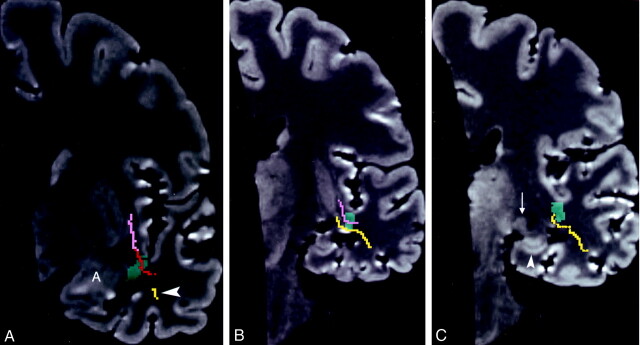 Fig 12.