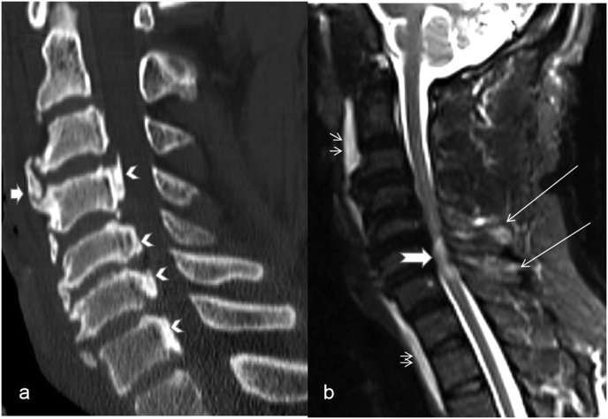 Fig. 2