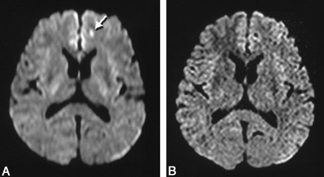 Fig 3.