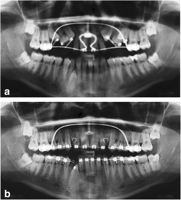 Fig. 5