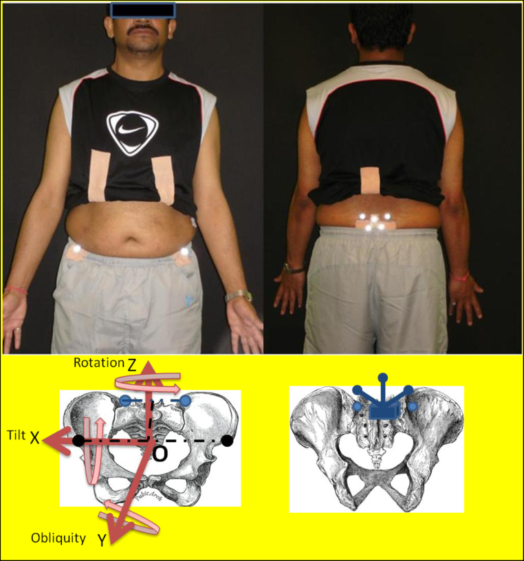 Fig. 1