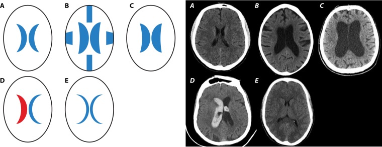 FIG 1