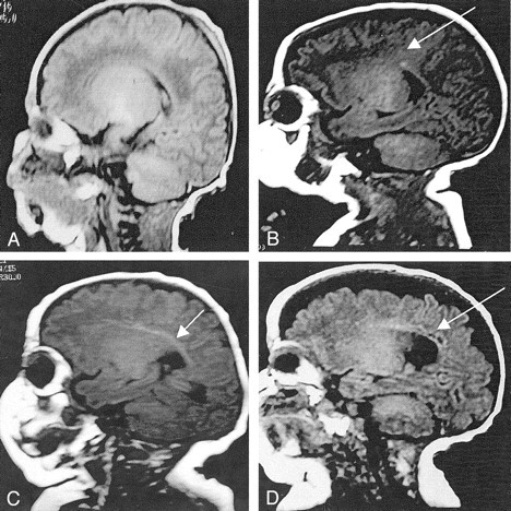 Fig 2.