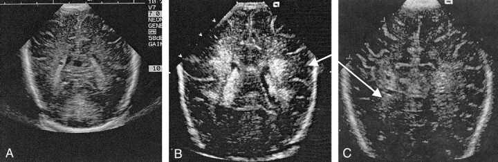 Fig 1.