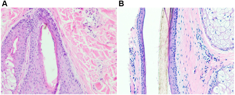 Figure 18