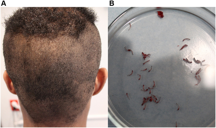 Figure 13