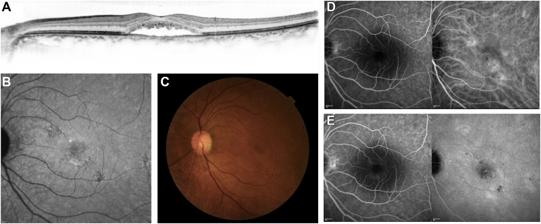 Figure 1