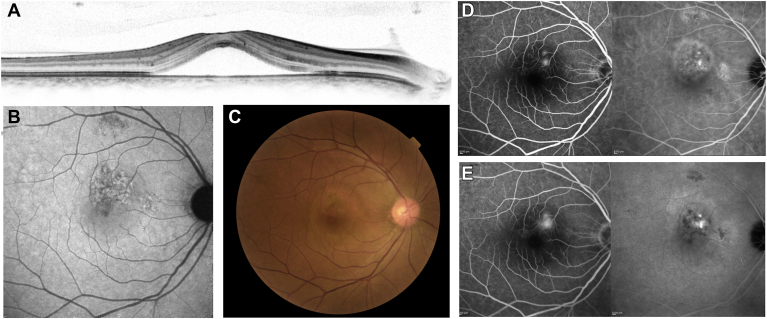 Figure 2