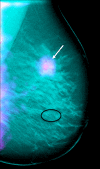 Figure 2c: