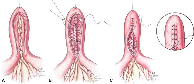 Fig. 2A-C