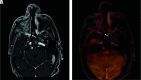 FIG 4.