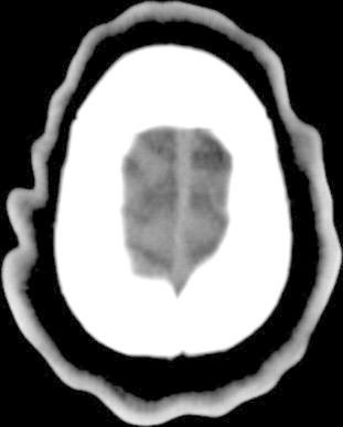 Fig. 12