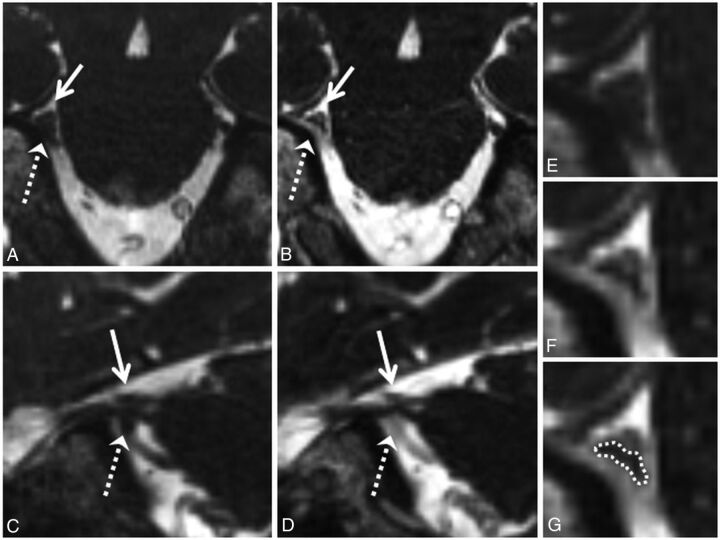 Fig 2.