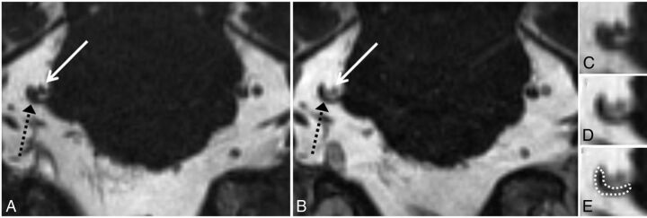 Fig 3.