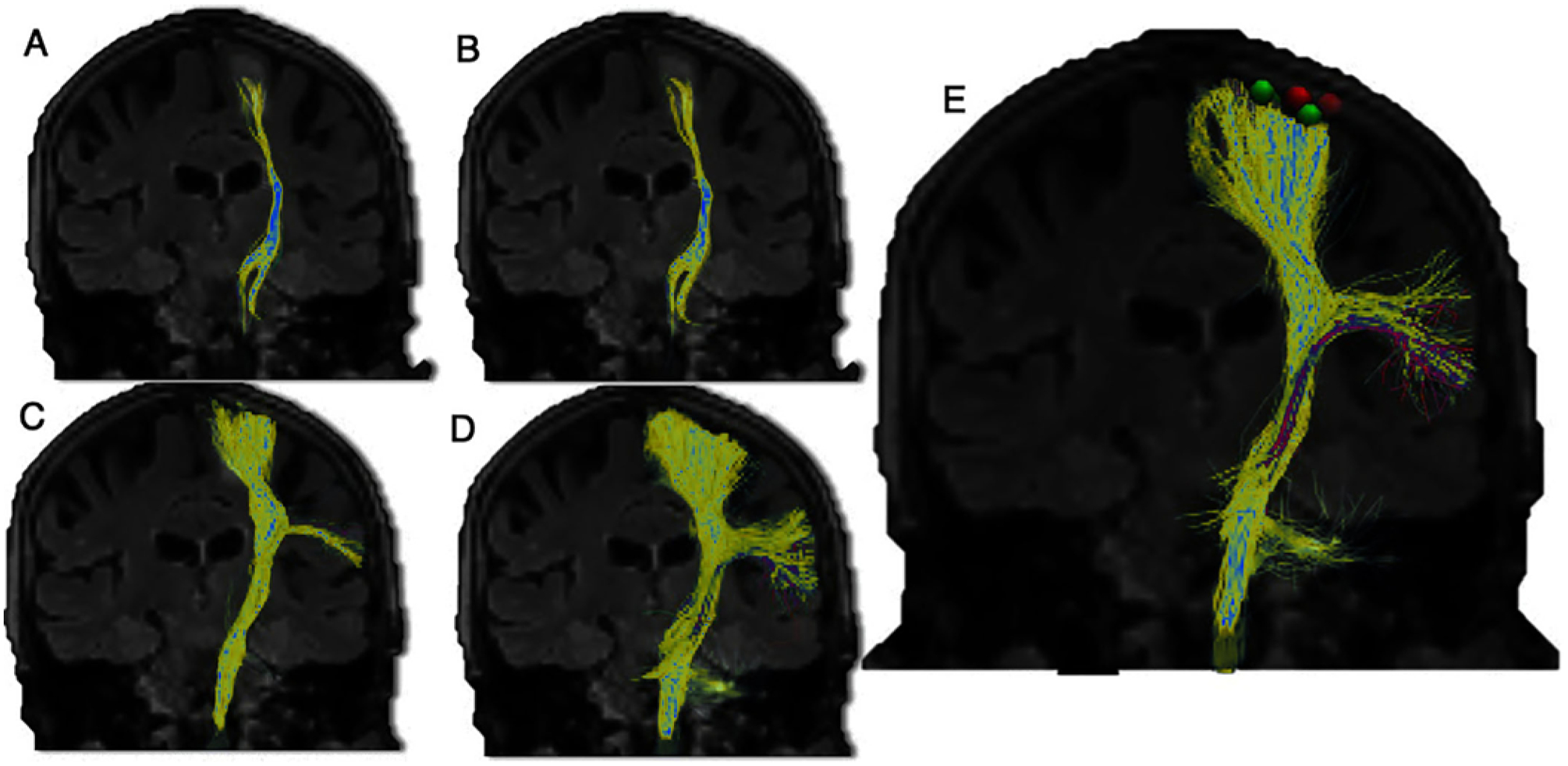 FIG. 4.