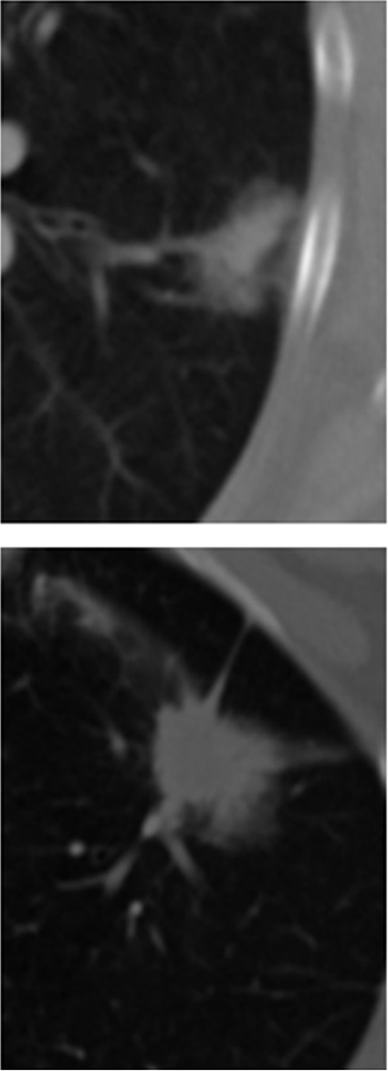 Figure 5a: