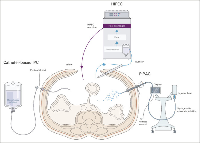 FIG 4.