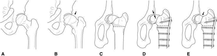 Fig. 1A–E