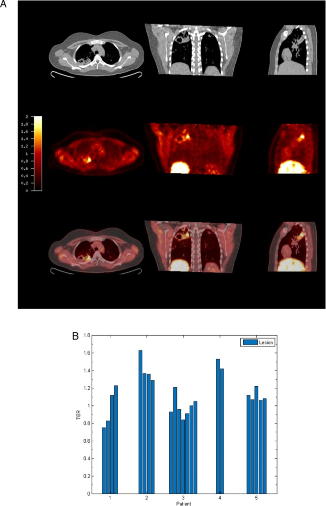 Figure 1