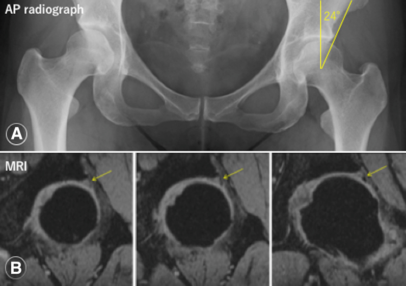 Fig 2