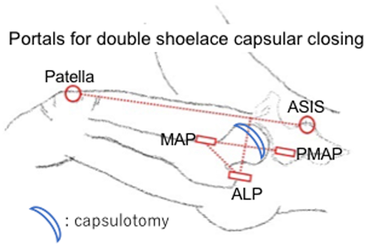 Fig 1