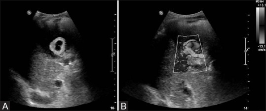 Figure 1(A and B)