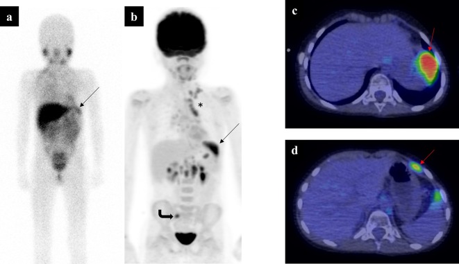 Figure 10. 