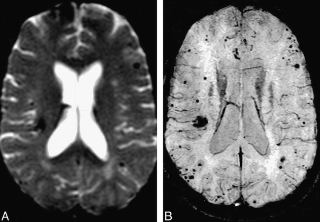 fig 2.