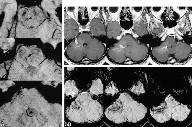 fig 4.