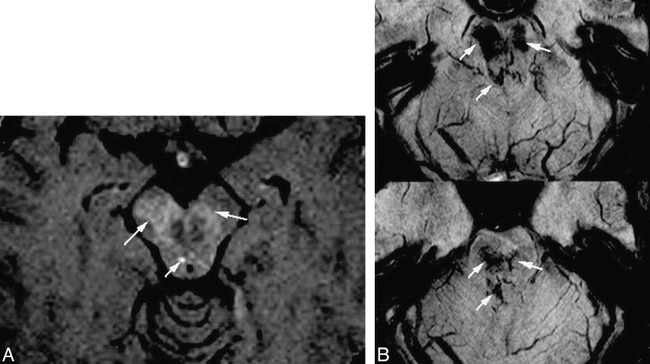 fig 3.