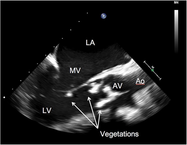 Figure 2