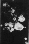 95