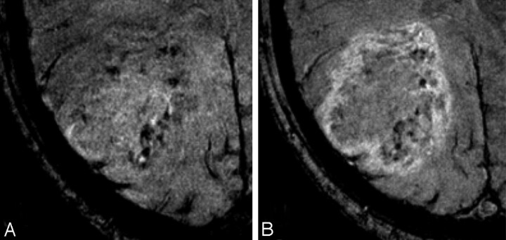 Fig 3.