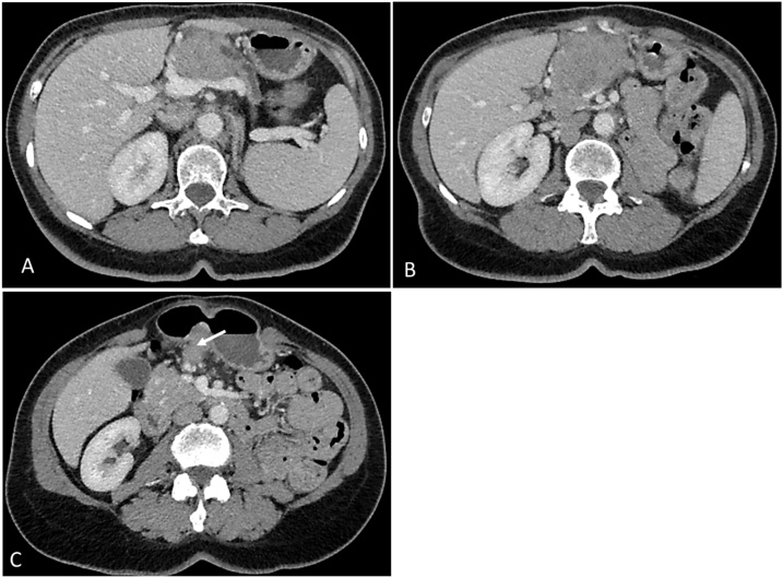 Fig. 1