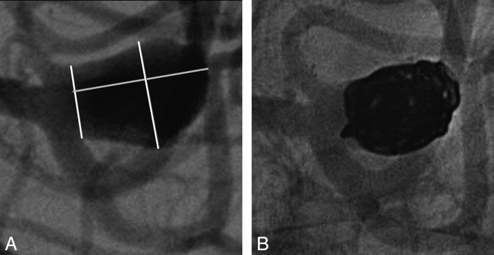 Fig 4.