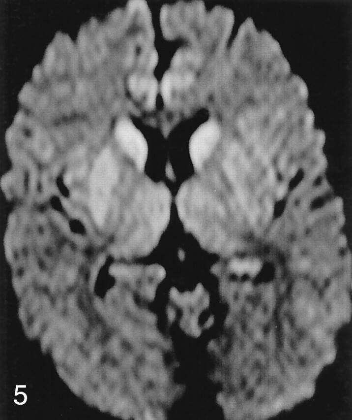 Fig 5.