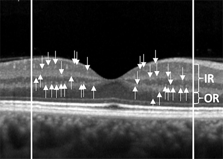 Fig 1