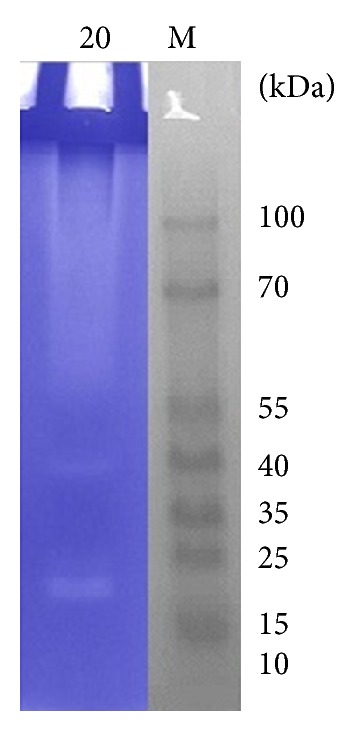 Figure 14