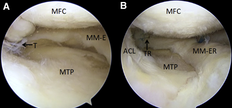 Fig 12