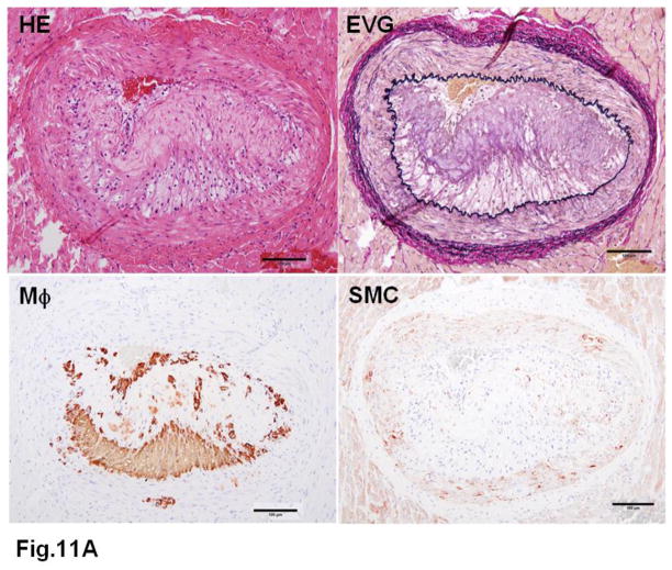 Fig. 11