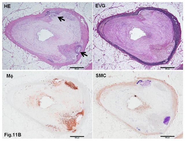 Fig. 11