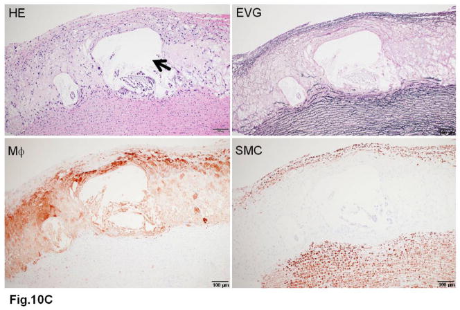 Fig. 10