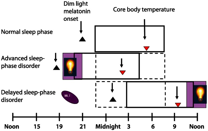 Figure 7-4