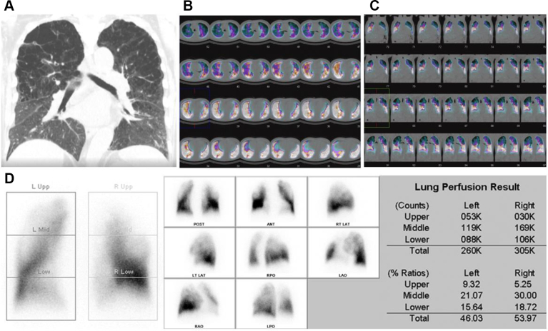 Figure 13