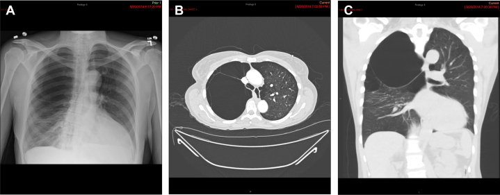 Figure 1