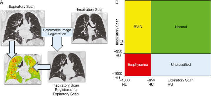 Figure 14