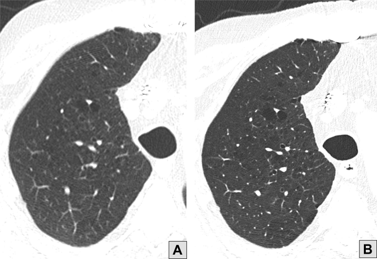 Figure 11