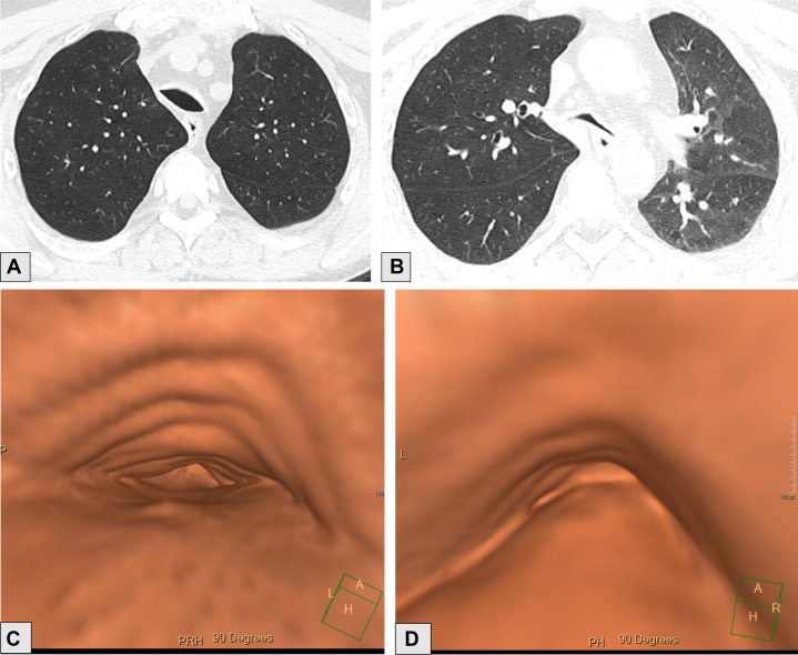 Figure 4