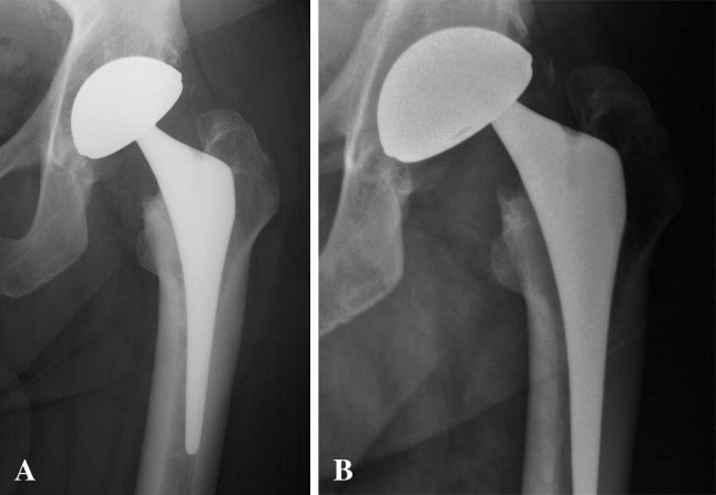 Fig. 2A–B