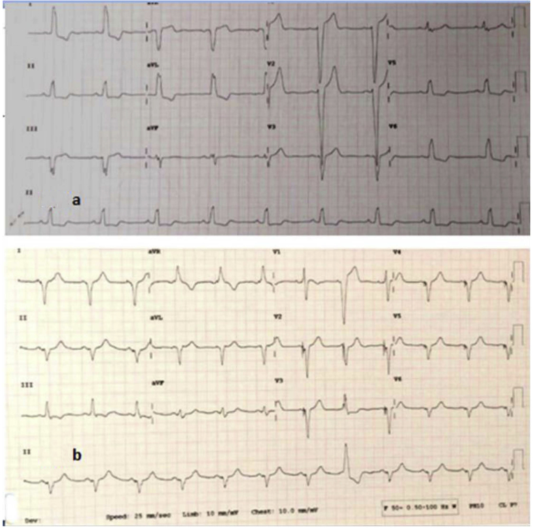 Fig. 3